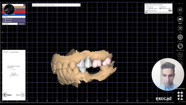 How to Use Virtual Articulator in exocad For Dynamic Occlusion смотреть онлайн