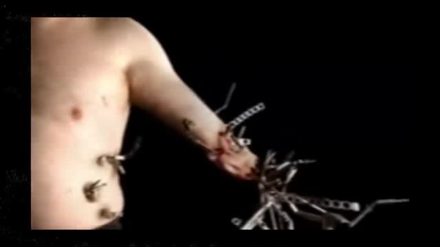 UNA ENFERMEDAD TERRORÍFICA-- Metalosis Maligna y Oscar el cuerpo modular (Analog Horror) смотреть онлайн