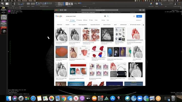 STR Cardiothoracic Case Webinar 10/29/2020 смотреть онлайн