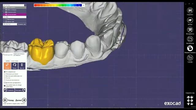 ExoCad Video смотреть онлайн