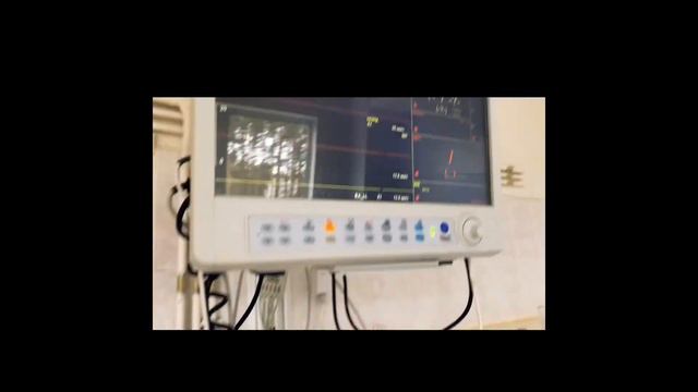 Актуальное! Применения пульсоксиметрии с COVID19