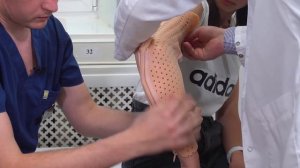 Пластиковый гипс ортез на локтевой сустав