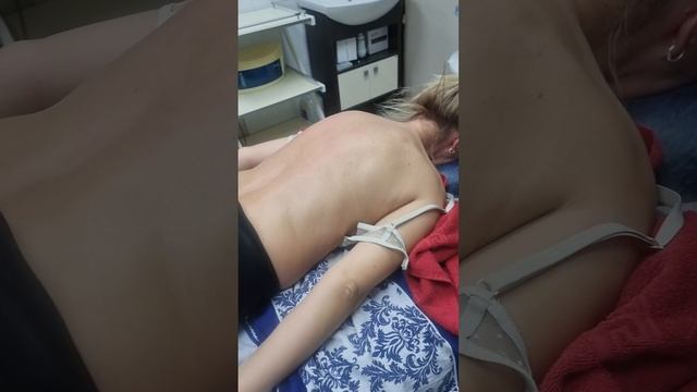 огромный кифоз смотреть онлайн