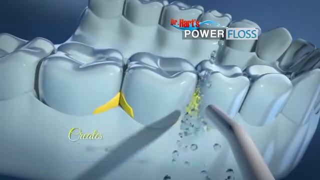 Portable Oral Irrigator Dental Hygiene Floss смотреть онлайн