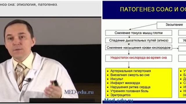 1_Синдром обструктивного апноэ сна: этиология и патогенез. Р.В. Бузунов смотреть онлайн