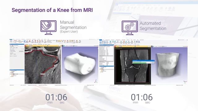 Automated vs Manual Segmentation of Knee MRI Data in Simpleware Software смотреть онлайн