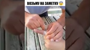Лайфхак: Как снять кольцо с опухшего пальца