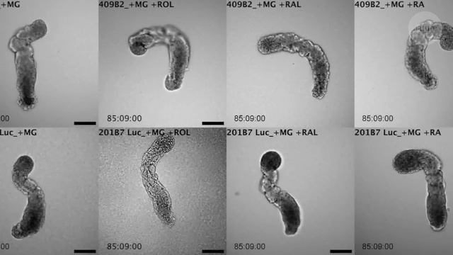 'Artificial embryos': the hidden steps in forming a spine смотреть онлайн