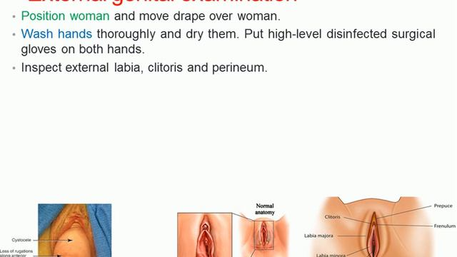 Gynecological Examination смотреть онлайн