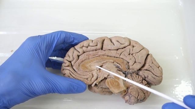 Рельеф медиальной и нижней поверхности полушарий: борозды и извилины