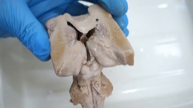 Промежуточный мозг. Анатомия промежуточного мозга смотреть онлайн