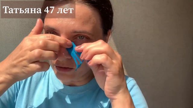 Тейпирование от отёков глаз смотреть онлайн