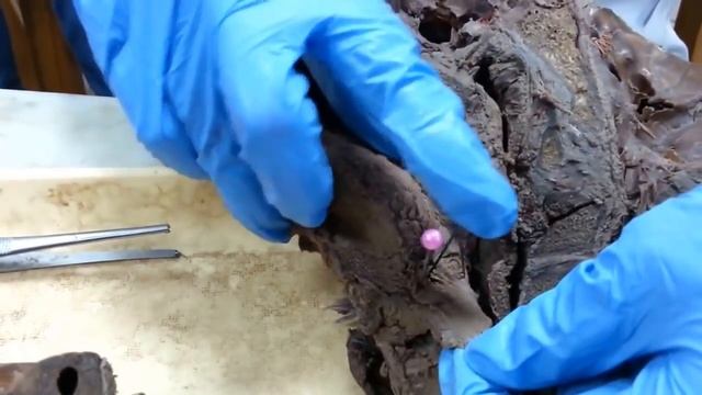 Module 17 - GIT - Practical Anatomy - dr Wafaa Abdelrahman - Soft Tissue - Part 3 смотреть онлайн