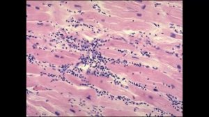 Лекция Компенсаторно-приспособительные процессы.mp4