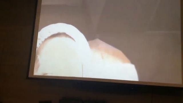 Семинар  контурная пластика филлер Brilliance