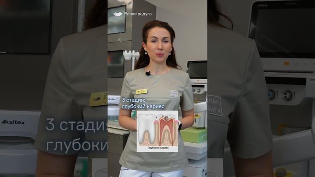 4 стадии развития кариеса смотреть онлайн