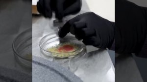 Как лечить стоматит?