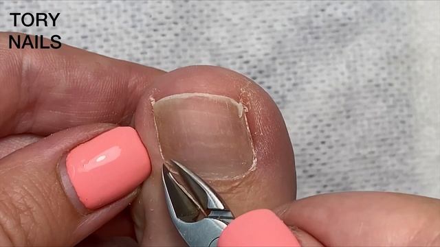 Педикюр | Безопасная фреза в педикюре | Педикюр себе | Педикюр пальчики