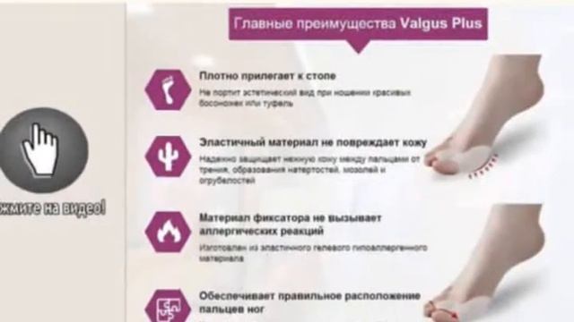 Вальгус Варус