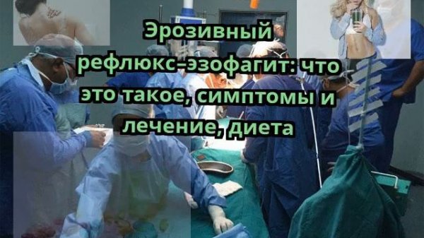 Эрозивный рефлюкс–эзофагит: что это такое, симптомы и лечение, диета