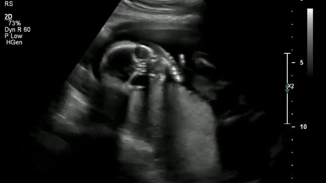 US AG смотреть онлайн