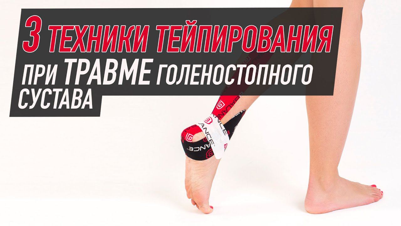 ✅ 3 техники тейпирования при травме голеностопного сустава | BBALANCE - учебный центр