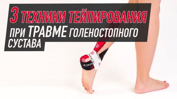 ✅ 3 техники тейпирования при травме голеностопного сустава | BBALANCE - учебный центр