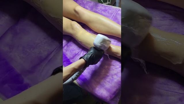 Лазерная эпиляция Soprano titanium 1800w смотреть онлайн