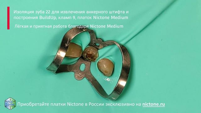 Изоляция зуба 22 для извлечения анкерного штифта и далее BuildUp, кламп B2 платок Nictone Medium 4K смотреть онлайн