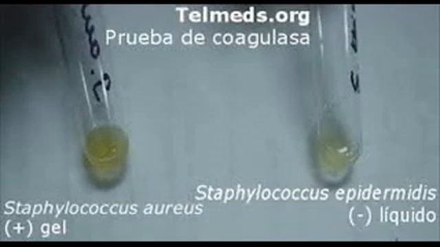 Staphylococcus Aureus 1) смотреть онлайн