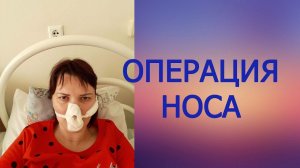Операция пластика носа, удаление кисты гайморовой пазухи