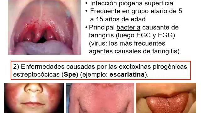 3b Micro I Clase:  Streptococcus Spp
