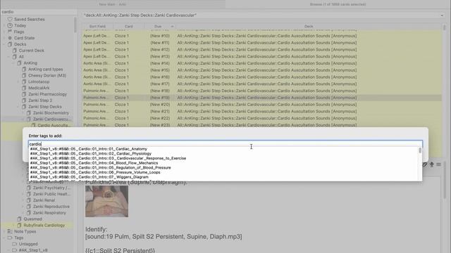 Organise Your Anki Cards With Tags! | How To Use Tags In Anki