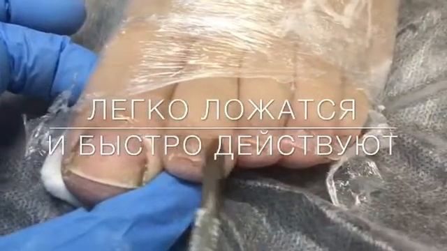 Обработка пальцев ног с Golden Trace смотреть онлайн