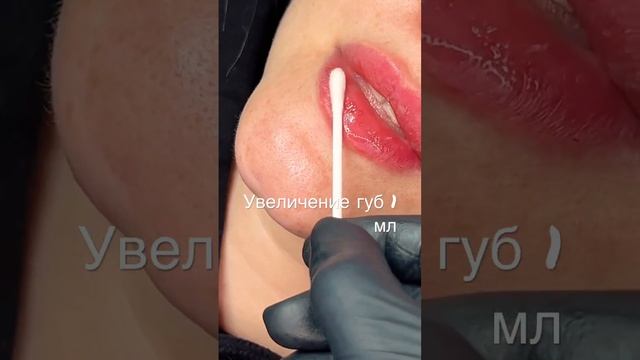 Нежность ✨ #ташкент #косметика #косметология #увеличениегуб #уход #уходзакожей