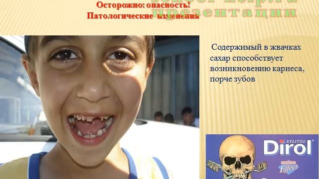 Презентация Жевательная резинка смотреть онлайн
