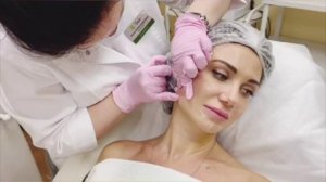 Биремоделирование PROFHILO (ПРОФАЙЛО) - процедура