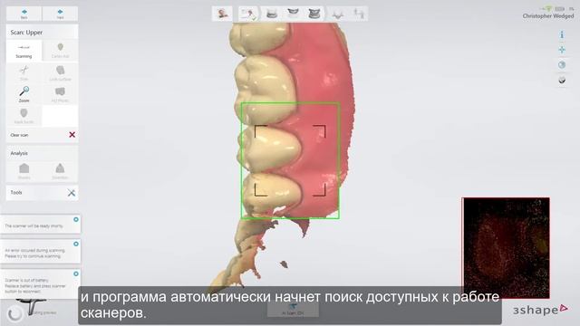 3Shape TRIOS3 Wireless - Повседневное использование сканера - Daily use смотреть онлайн