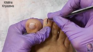 НАРАЩИВАЮ ногти НА НОГАХ?Надлом большого ногтя?Что делать? СВЕТООТРАЖАЮЩИЙ ТОП IRISK 01 ?