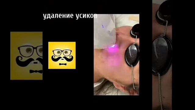 Лазерная эпиляция верхняя губа смотреть онлайн
