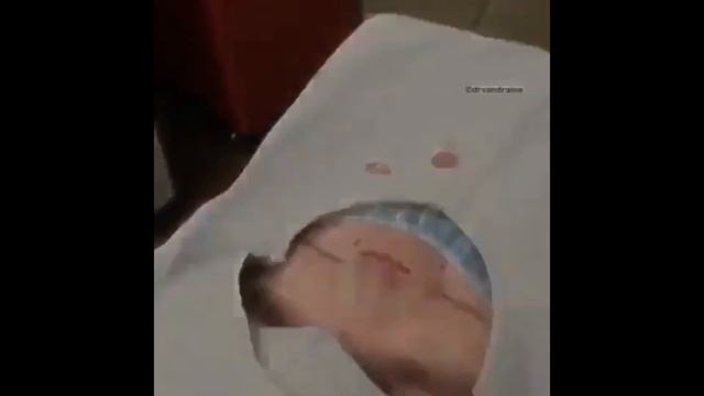 Гигантские прыщи, огромный угри/pustules, pimples, blackheads and black dots смотреть онлайн
