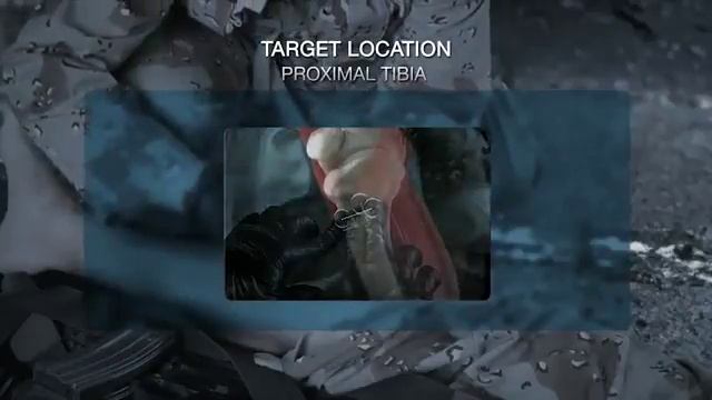 NIO™ Intraosseous Device Overview