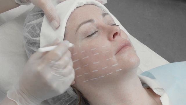 Mастер класс на препарате PLINEST Работа с отечно деформационным типом старения смотреть онлайн