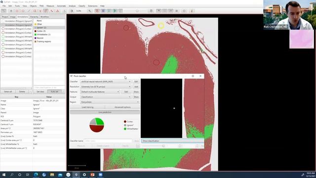 QuPath Software Overview and Applications for Neuropathology Research Webinar - 12.13.21 смотреть онлайн