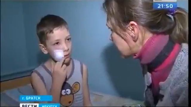 В Братске домашняя собака напала на семилетнего мальчика Из за травмы лица он оказался в больнице смотреть онлайн