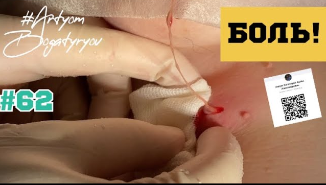 62. УЖАС, у неё БОЛИТ! Помогаем и облегчаем качество жизни!