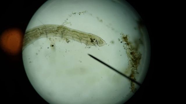 Naididae Freshwater Flatworm 3 смотреть онлайн