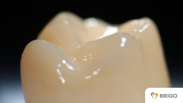 VarseoSmile Crown Plus