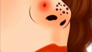 ASMR Nose Worm Infection Removal, Nose piercing filled with maggots |Asmr Animation