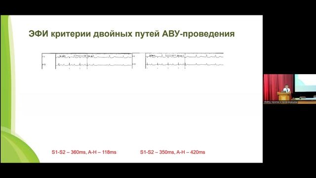Давтян К.В. ЭФИ диагностика. Ведение пациентов с НЖТ..mp4